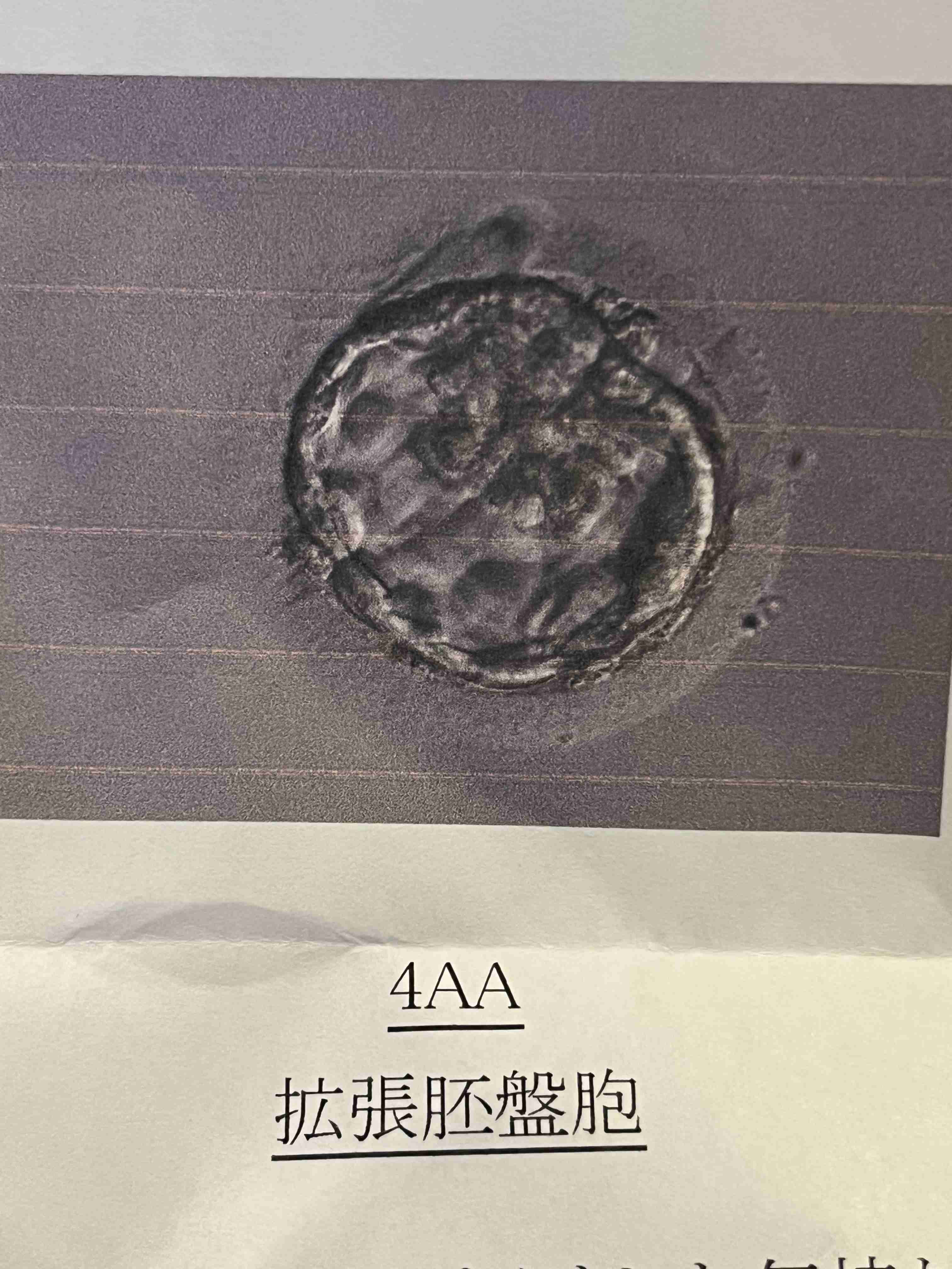 体外受精している方、経験者の方!Part5
