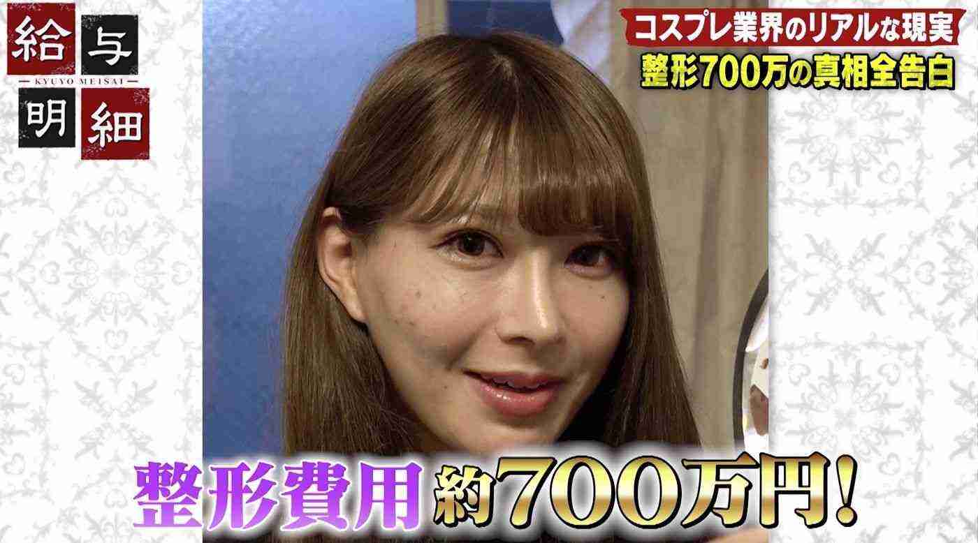 美容整形の低年齢化、問われる美容医療の“質” 現役医師が抱く危機感「法整備が必要な局面に来ている」