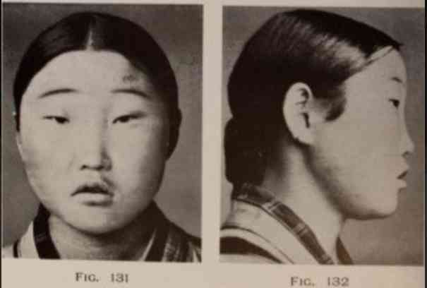 やまないアイヌ差別、道内外での違いも 「今のままでは“標本”の勉強に終わる」当事者に聞く課題