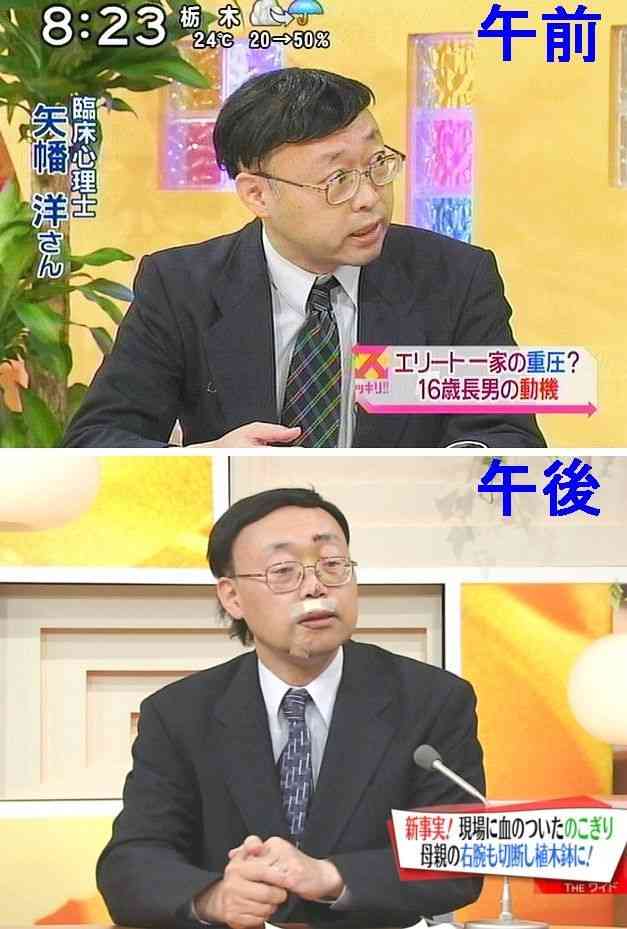 『news zero』卒業発表の有働由美子アナ、階段を踏み外して顔を負傷 腫れて「凄い絆創膏」心配が殺到