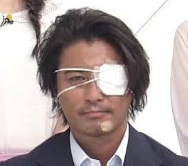『news zero』卒業発表の有働由美子アナ、階段を踏み外して顔を負傷 腫れて「凄い絆創膏」心配が殺到