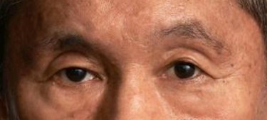 目だけで有名人を当ててください