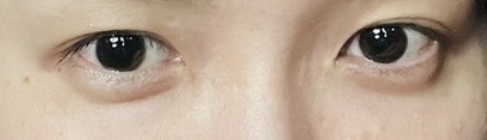 目だけで有名人を当ててください