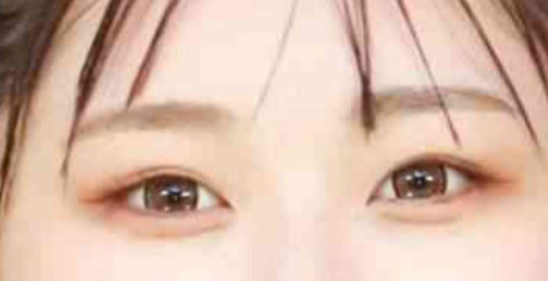 目だけで有名人を当ててください