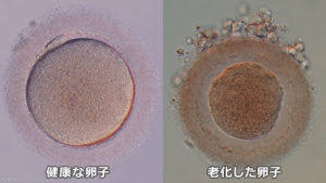 老化で精子の遺伝子制御が変化、子の神経発達障害リスクに 東北大