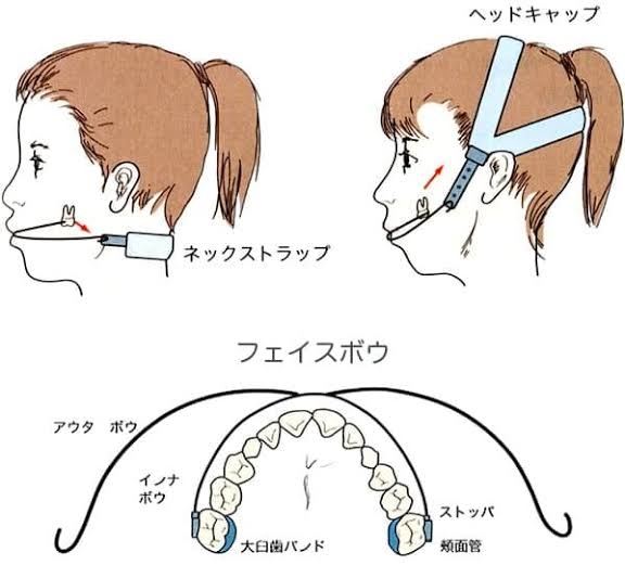 【表側か】歯列矯正【裏側か】