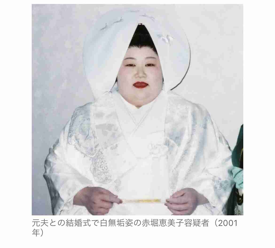 生後6カ月の娘の容姿に悩んだ母 夫の前で感情爆発「整形させるから」