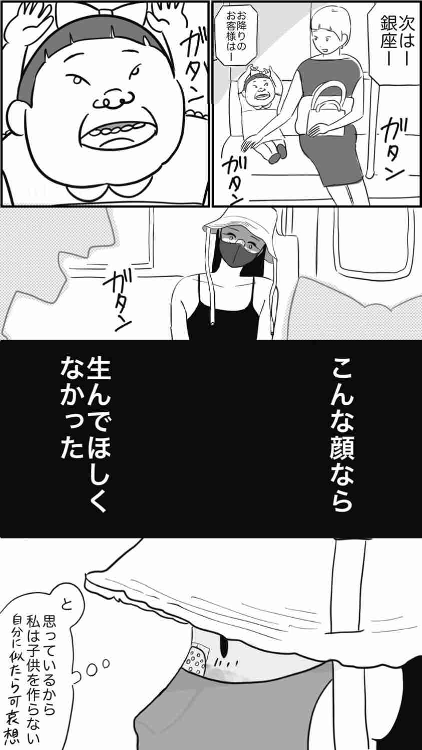 生後6カ月の娘の容姿に悩んだ母 夫の前で感情爆発「整形させるから」