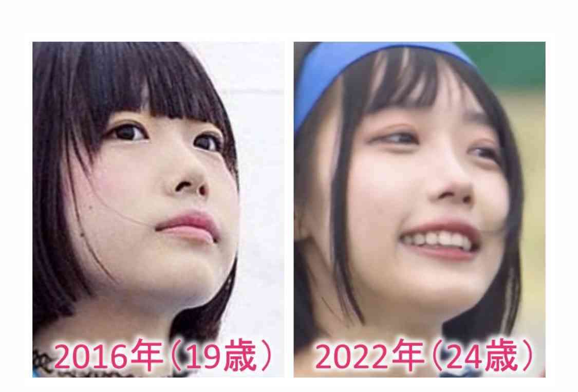 あのちゃん：金髪センター分け＆金眉で雰囲気激変！　“歌手ano”として「レコ大」登場　「デヴィッド・ボウイみたい」と反響