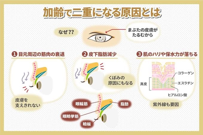 一重から整形なしで二重になった人、いつなりましたか?
