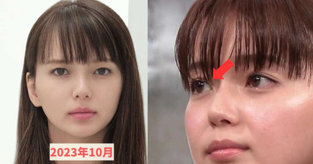 二重埋没総合トピ