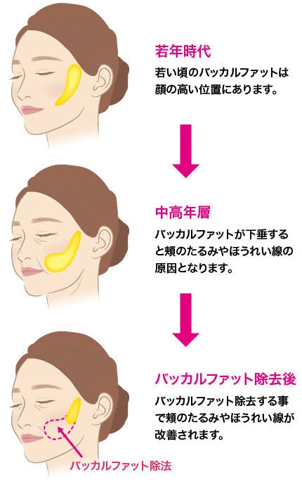 アラフォーの老化の理想と現実→土台から崩れてくるの怖過ぎる…