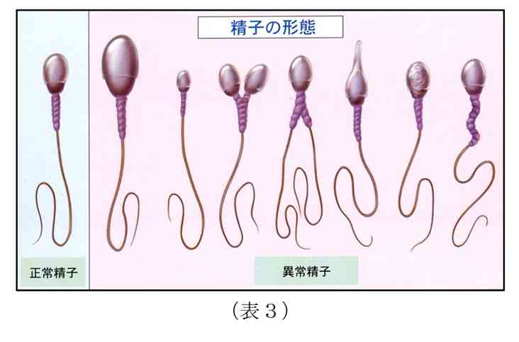 発達障害の人の家族に多い「カサンドラ症候群」なりやすい人、なりにくい人チェック