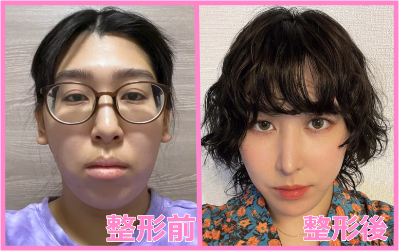 美人か不美人かを決める顔の中で最も重要なパーツ