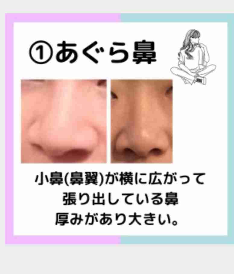 美人か不美人かを決める顔の中で最も重要なパーツ
