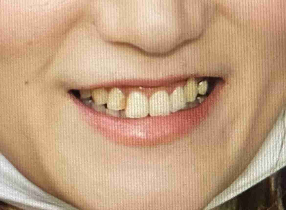 美人か不美人かを決める顔の中で最も重要なパーツ