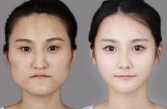 美人か不美人かを決める顔の中で最も重要なパーツ
