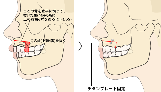美人か不美人かを決める顔の中で最も重要なパーツ
