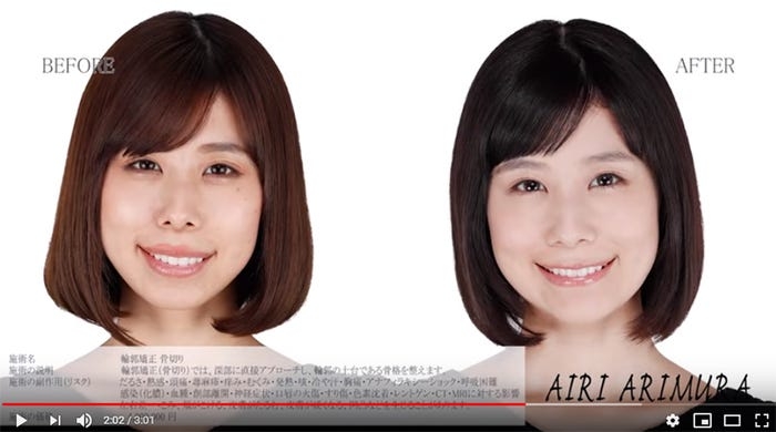 美人か不美人かを決める顔の中で最も重要なパーツ