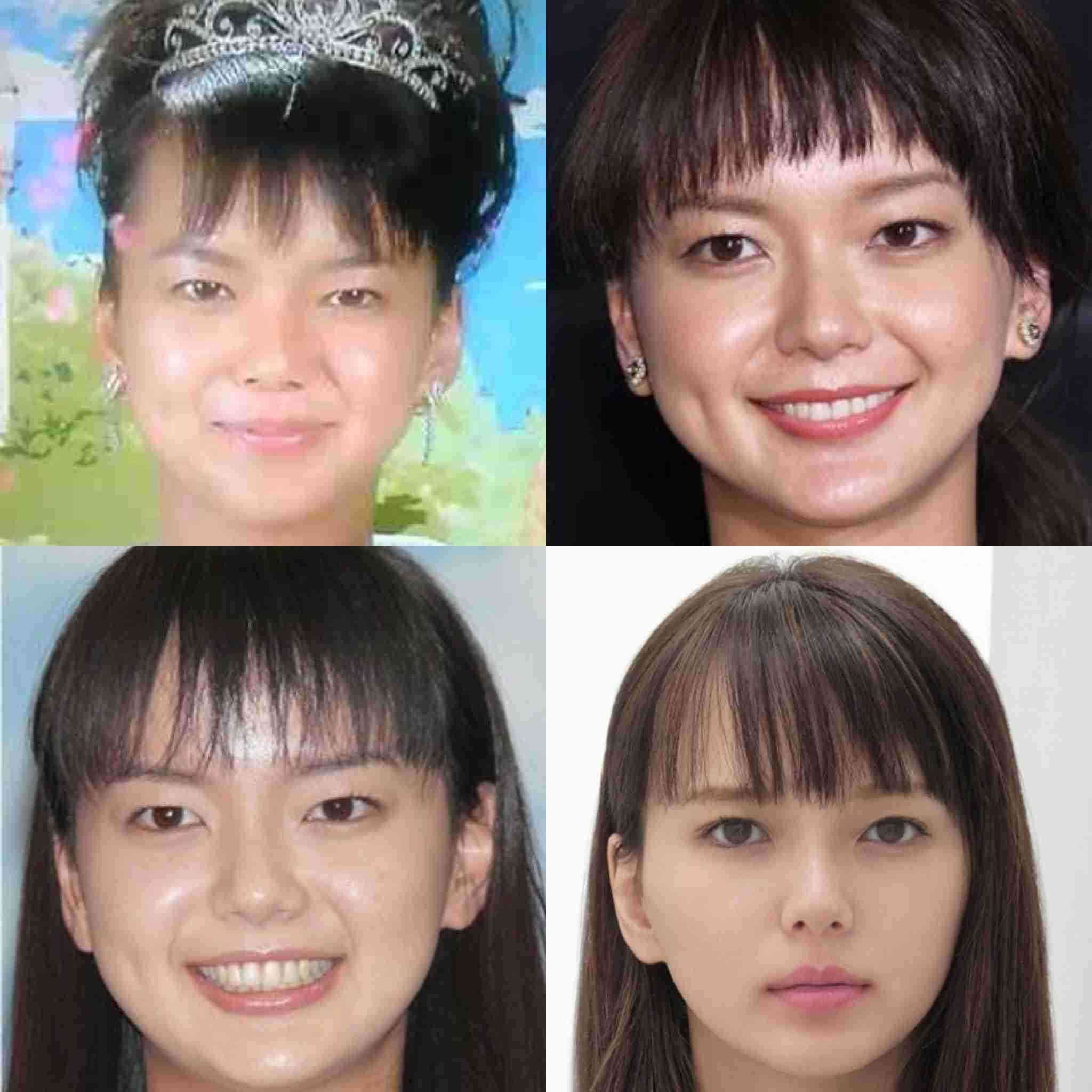 二重整形したら？と言われた