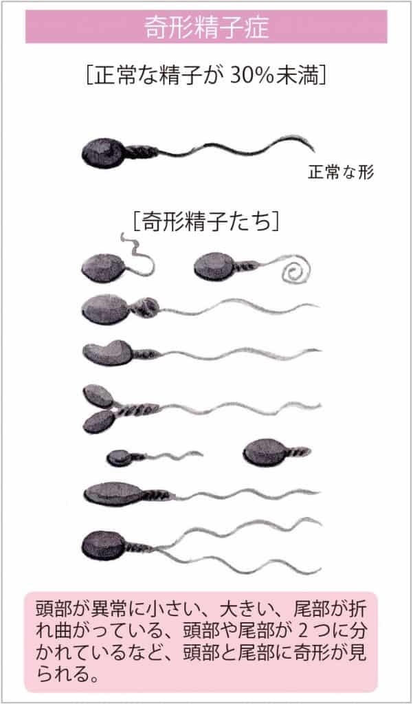 旦那から選択子なしを後悔してると言われた