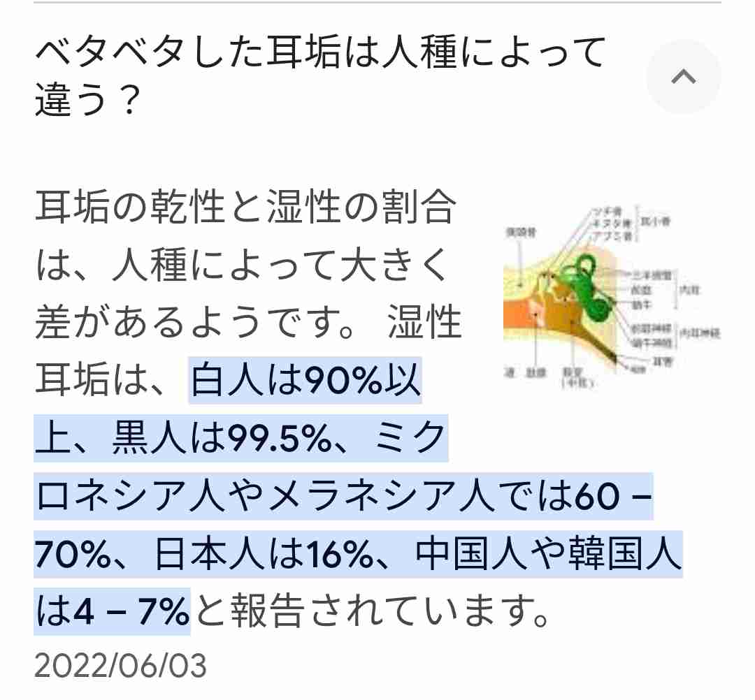 耳垢カサカサ派?しっとり派?