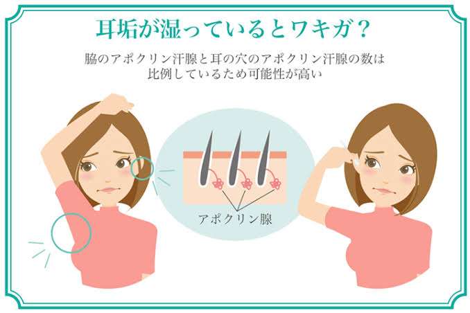 耳垢カサカサ派?しっとり派?