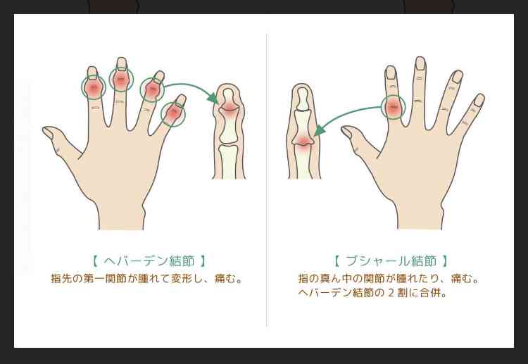 手に関する悩み語りませんか