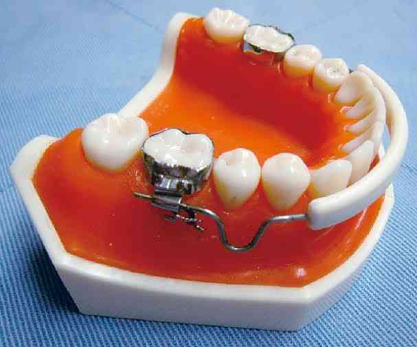 「こんなに変わるの!?」「めっちゃ綺麗！」　人気YouTuber、3年間の“歯列矯正ビフォーアフター”で垢抜け美女に大変身