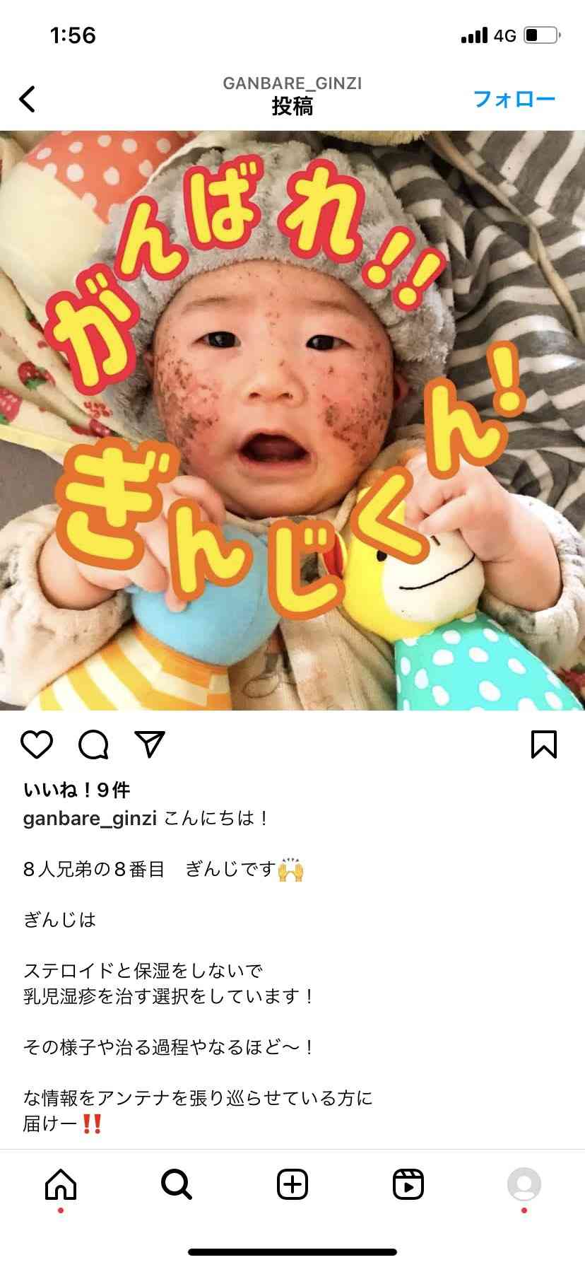 死ぬほど苦しんだ娘に「免疫がついてよかったね」…親が“自然派”でワクチン打たず、「はしか」感染で入院