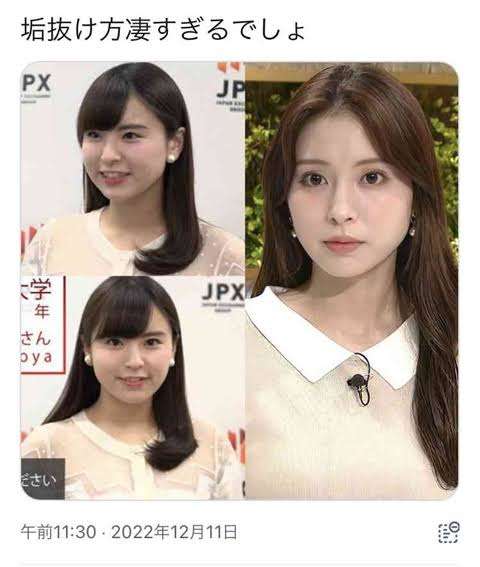 ミス筑波大モデル、25キロ減量したビフォーアフターに「ホント凄い」　整形疑う声も「元々は埋もれてたようですね」