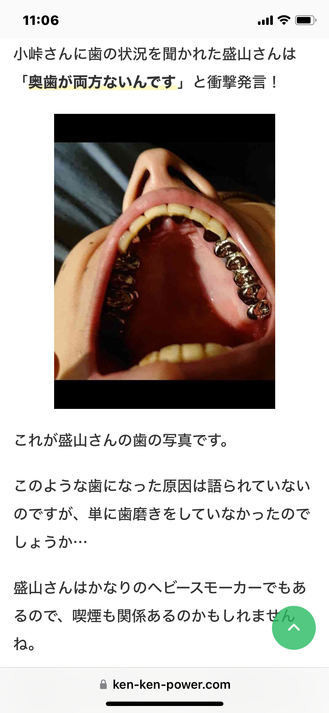 銀歯は印象がマイナス?