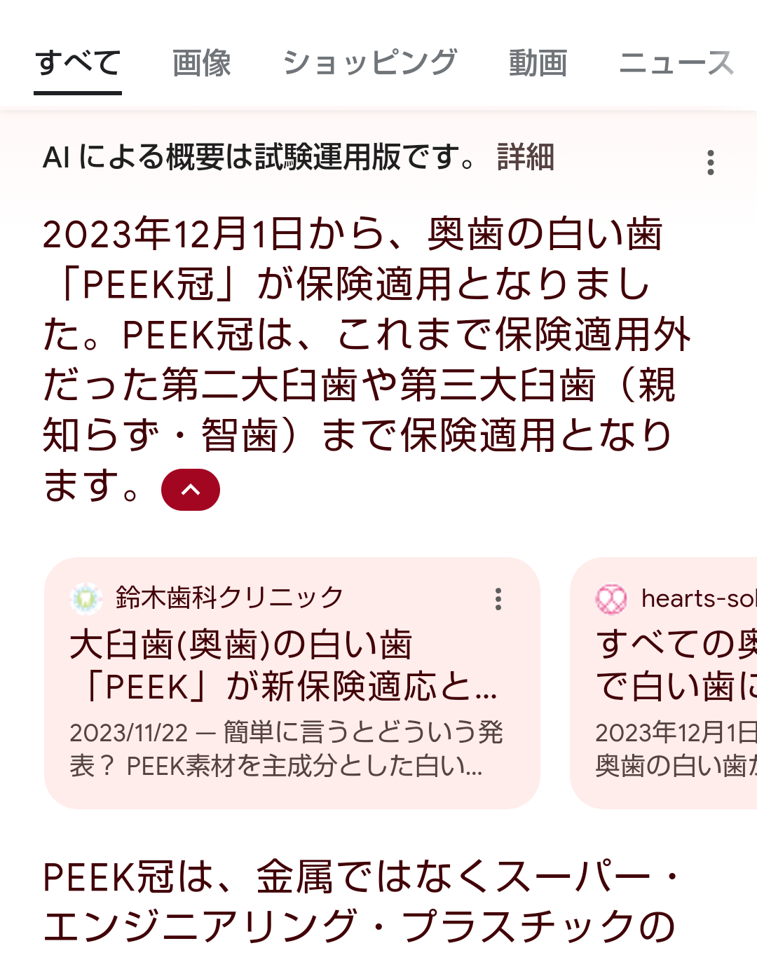 銀歯は印象がマイナス?