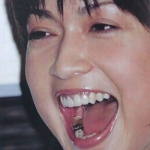 銀歯は印象がマイナス?