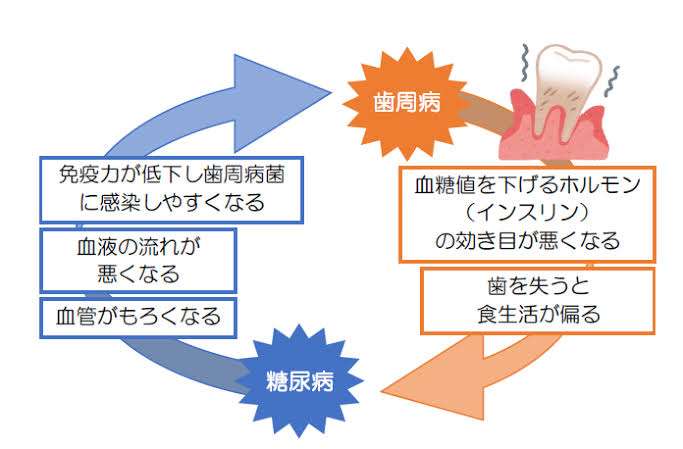 実は「加齢」だけじゃない!? 歯茎が下がる4つの原因、歯科医師が解説
