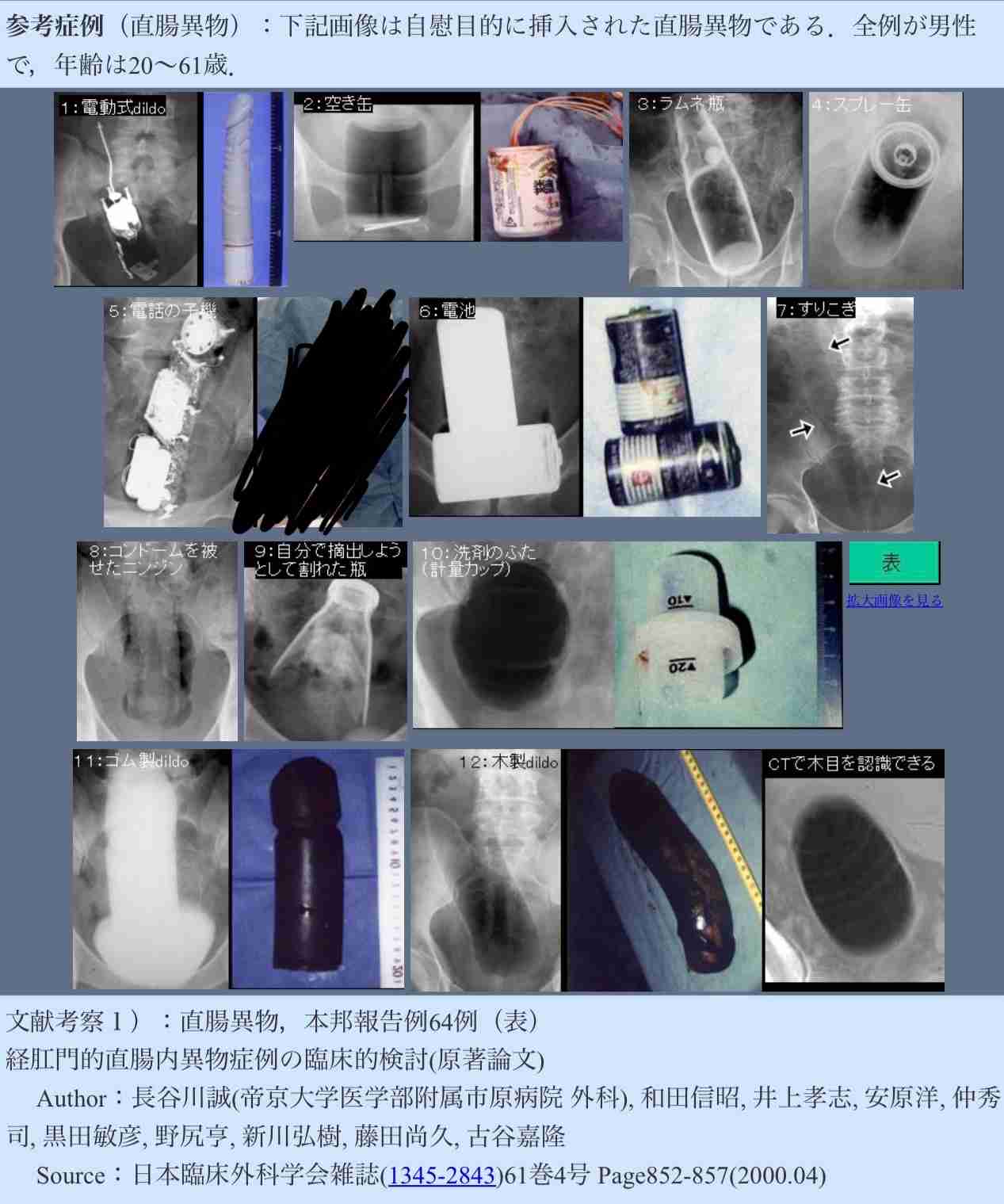公園の蛇口に肛門こすりつけた男を器物損壊容疑で逮捕　「性的欲求満たすため」犯行の動画や写真も　東京・世田谷区