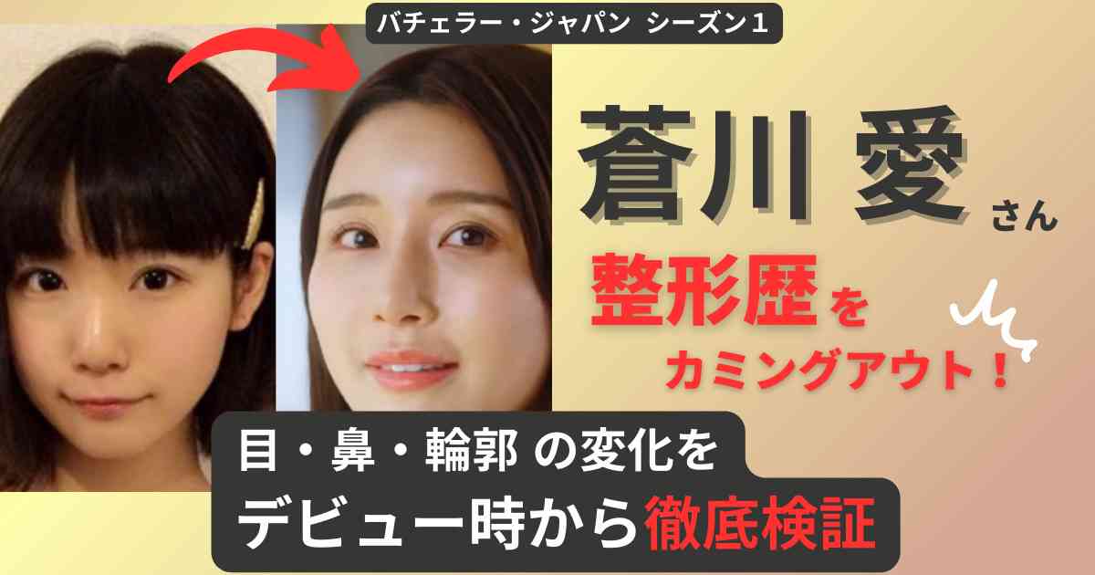 1歳の息子が指定難病に「早く気づけたら」と自分を責めた蒼川愛「肌が白すぎるけど大丈夫?」スーパーでのひと言が病気を知るきっかけだった