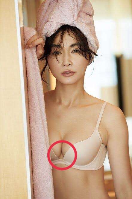 下乳の汗疹問題
