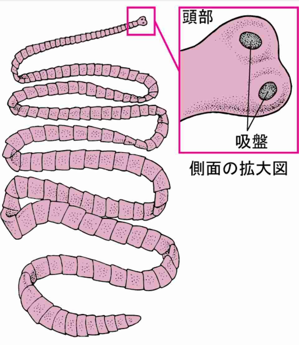【閲覧注意】タイで生の牛肉をパクパク食べた友人、帰国してトイレに行ったらお尻から3mの「アレ」が出てきて病院へ