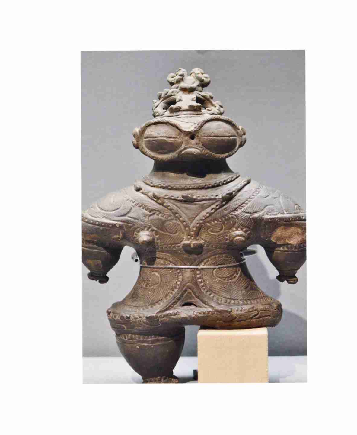 ウィルス性結膜炎
