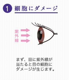 <感じ悪いの?>運動会でサングラスをするママは変?おかしくない?切実な事情があることも