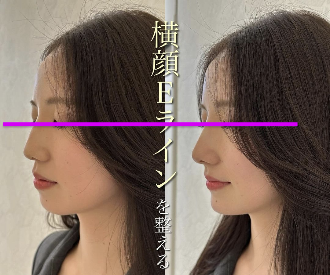 整形したがる娘にキレそうです