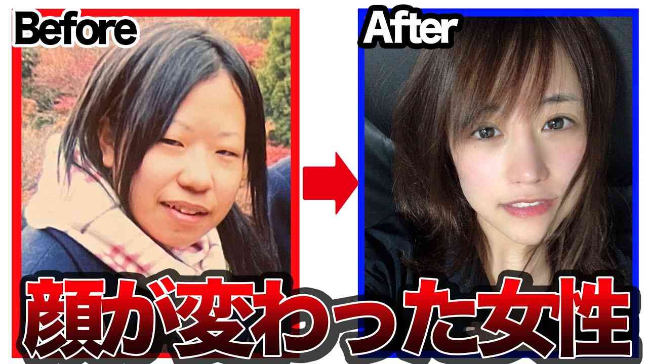 整形したがる娘にキレそうです