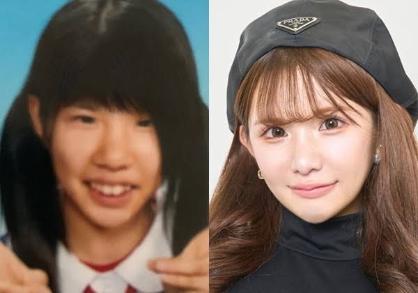 「あんたそんな顔整形してんの？」　平瀬あいり、親に整形バレて修羅場に「話し合いが必要」