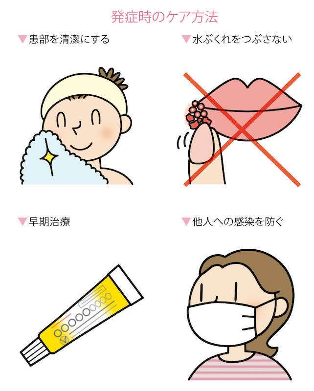 ヘルペス総合トピ