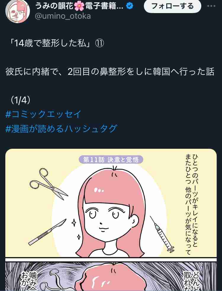 整形してる方、正直おいくら使いましたか？