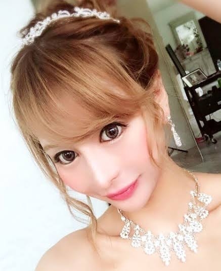 整形してる方、正直おいくら使いましたか？