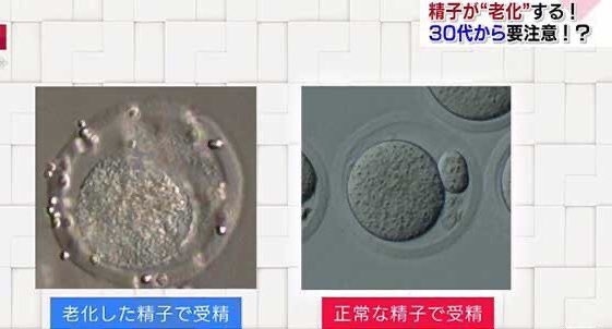 「年7億円」売上話題の人気キャバ嬢、整形手術後の「new鼻」披露 「クソコメ」は「うざい」と突き放す