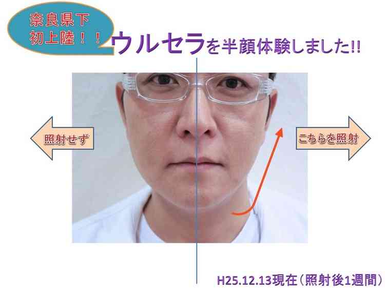 輪郭をシュッとさせたい