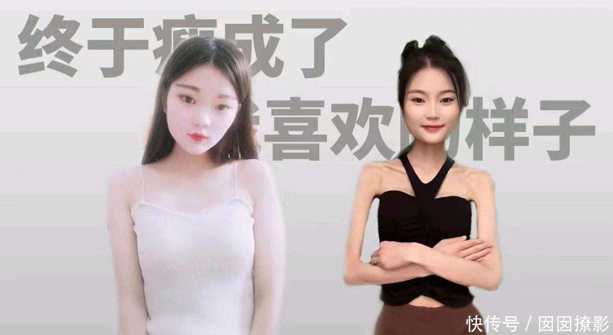 身長160センチ、体重25キロの女性「踊る骸骨」と揶揄されるも「もっと痩せたい」（中国）